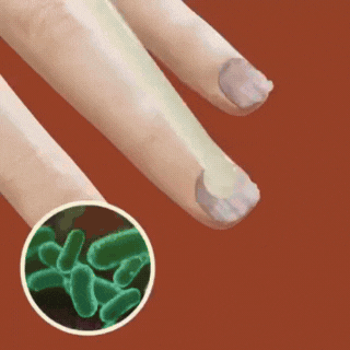 FungiKur™ Bienengift | Nagelpilz-Behandlungsspray