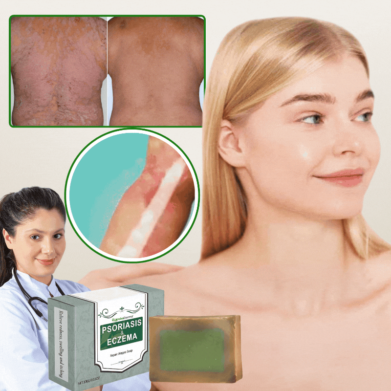 KrokoDerma™ | Krokodilöl-Seife gegen Psoriasis und Ekzeme