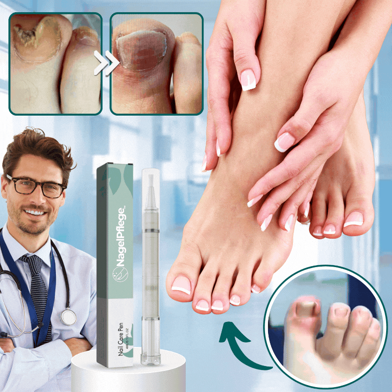 Nagelhautöl Stift Set 6PCS - Pflegendes Nagelöl Für Rissige Nägel, 6 Düfte (Kirsche, Lavendel, Etc.)