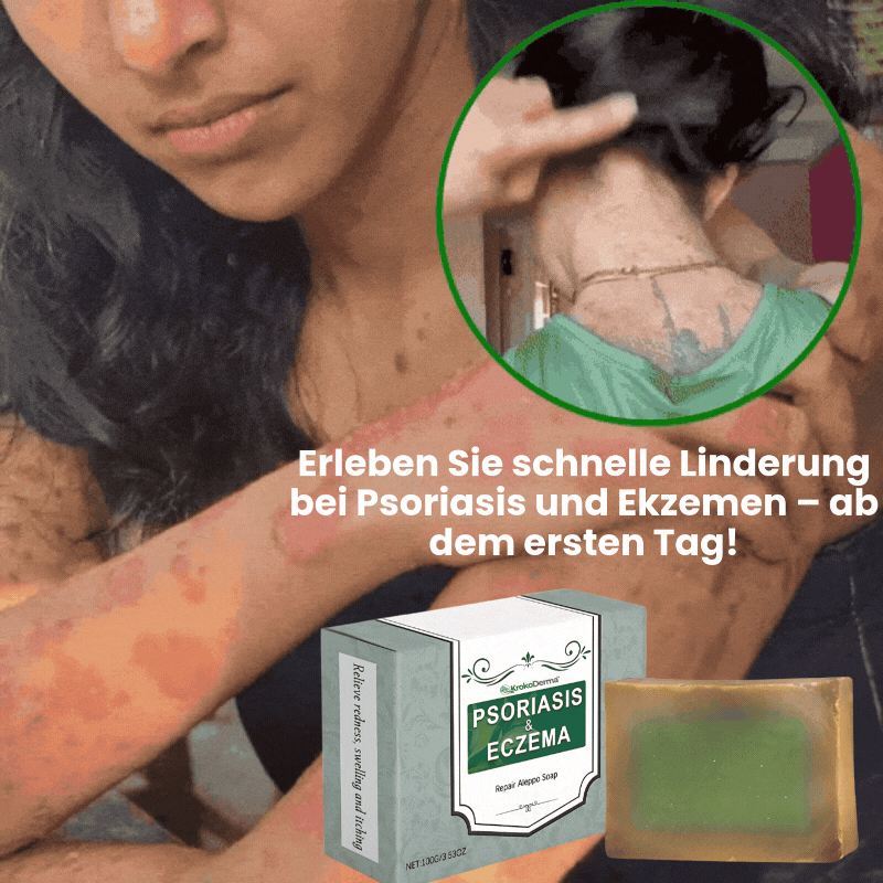 KrokoDerma™ | Krokodilöl-Seife gegen Psoriasis und Ekzeme