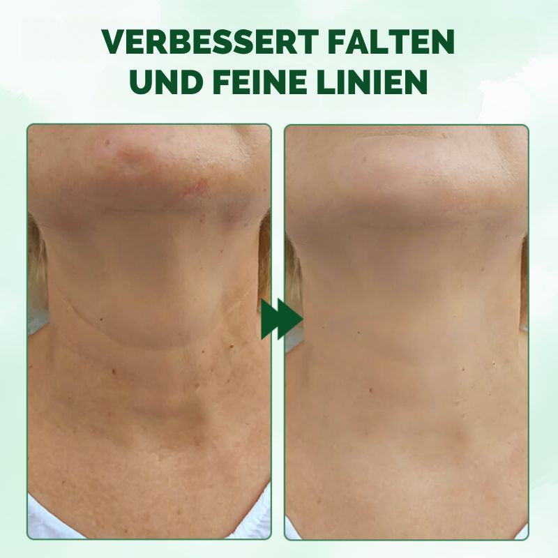 StraffÖl™ | Fortgeschrittenes Hautstraffungsöl