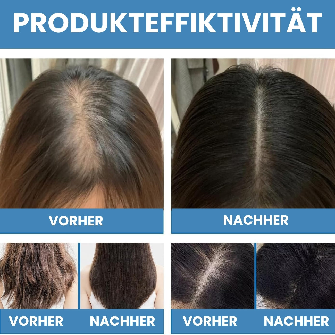 ReGrowth™ | Fortgeschrittenes Haarwachstums-Roll-On