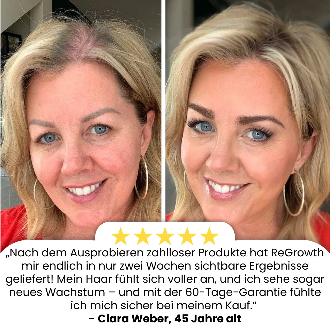 ReGrowth™ | Fortgeschrittenes Haarwachstums-Roll-On