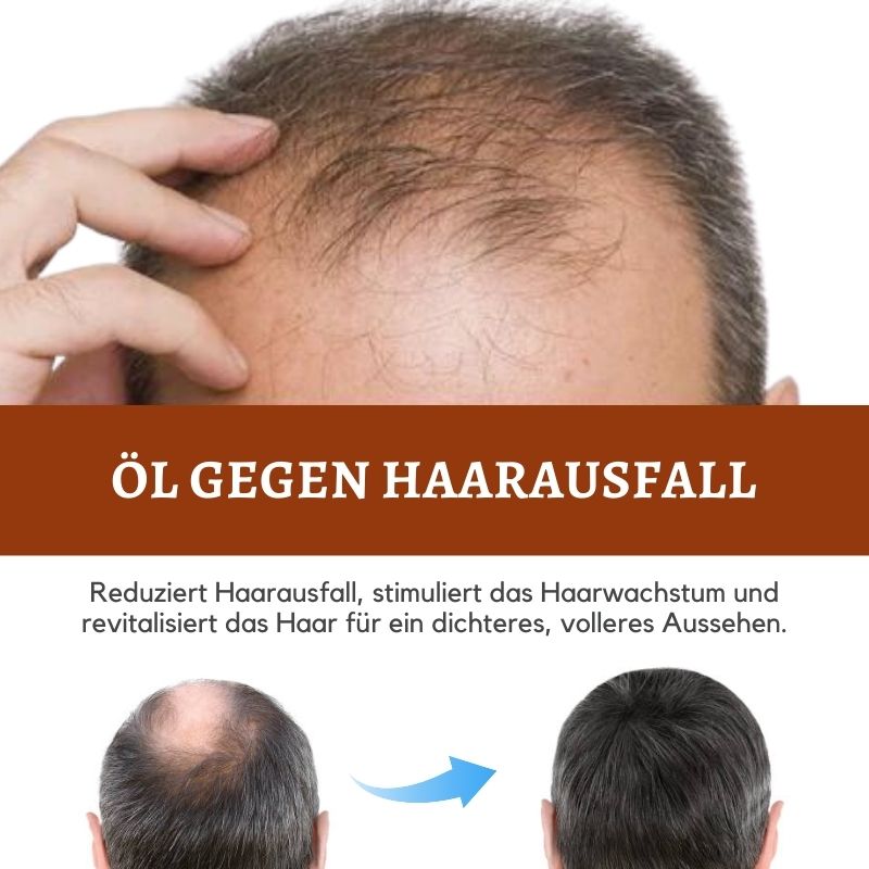 HaareBoost™ | Ashwagandha Haarwuchsöl