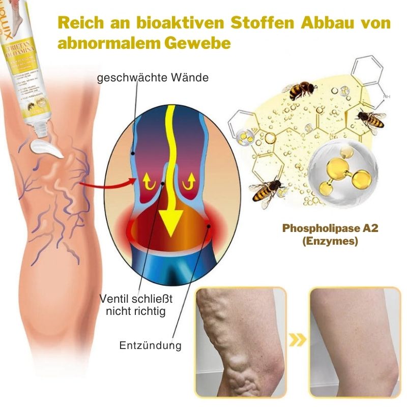 ArthroVeinSalbe™ | Creme zur Behandlung von Arthritis und Krampfadern