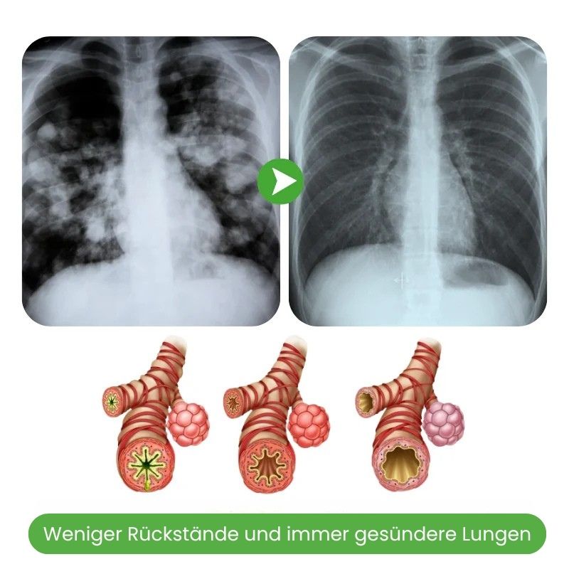 LungenRein™ | Atemklar Inhalator