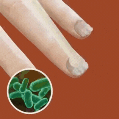 NagelKur™ | Nagelpflegegel