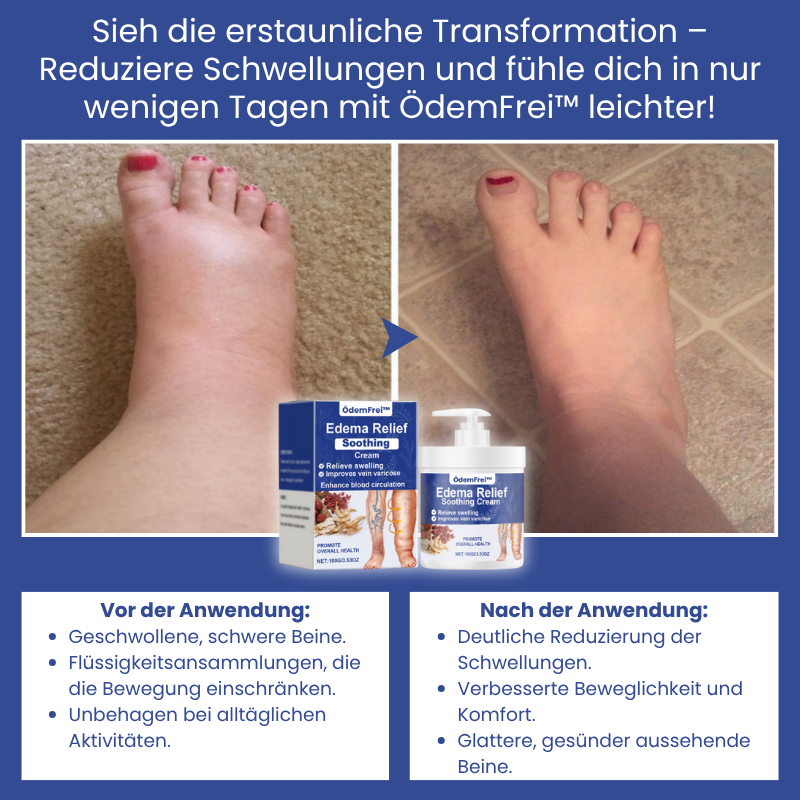 ÖdemFrei™ | Lindernde Creme bei Ödemen
