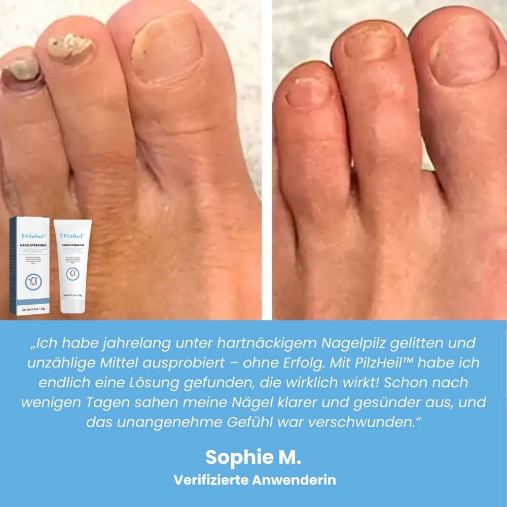 PilzHeil™ | Behandlungsgel für Fußnägel
