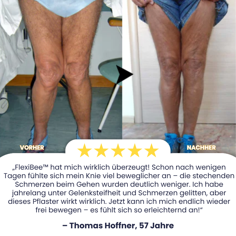 FlexiBee™ | Bienenvenom-Therapie-Pflaster