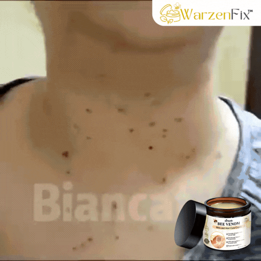 WarzenFix™ | Bienenstich-Reparatur- und Feuchtigkeitscreme