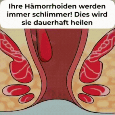 HemoHeilung™ | Pflanzliche Hämorrhoidencreme