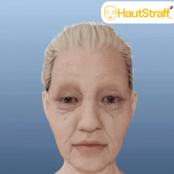 HautStraff™ | Hautstraffende Creme