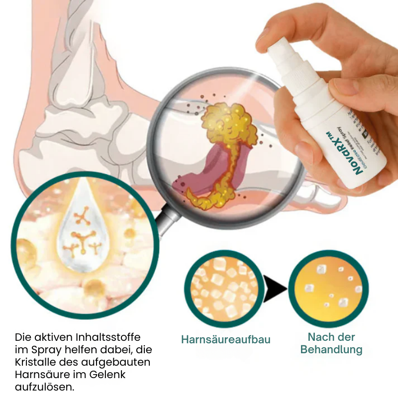 NovaRX™ | Gicht-Linderungs-Spray