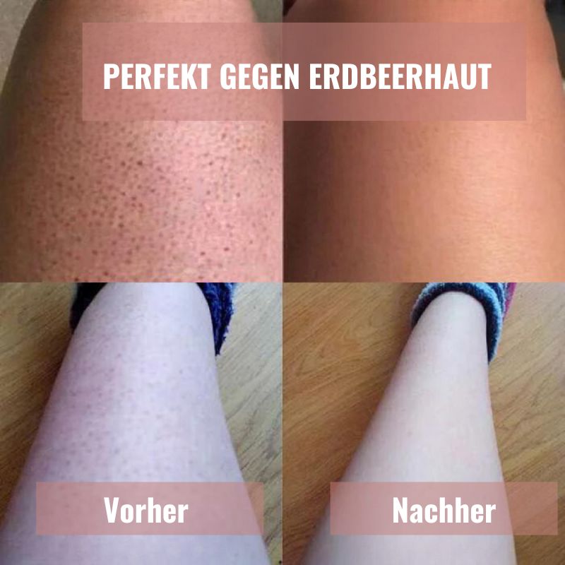 ZeroIrrit™ | Beruhigender Haut-Sicherheitsrasierer