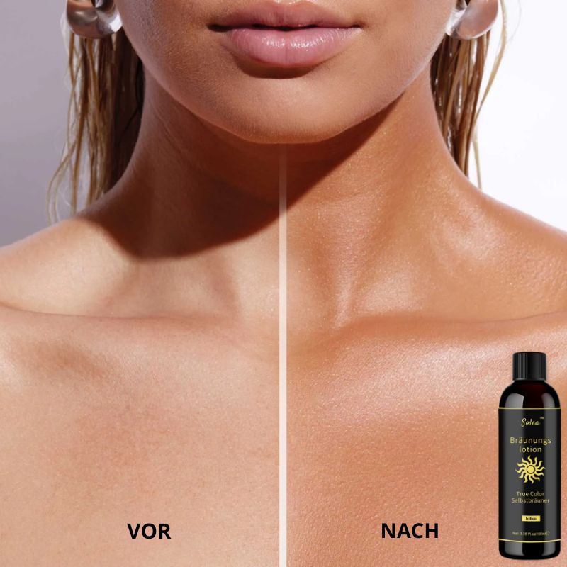 Solea™ | Bräunungslotion