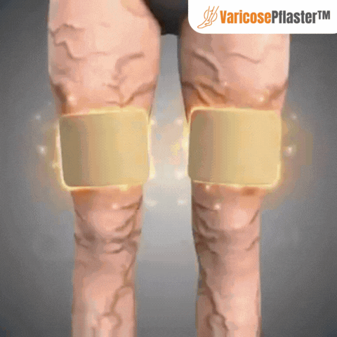 VaricosePflaster™ | Kurkuma-Krampfadern-Pflaster