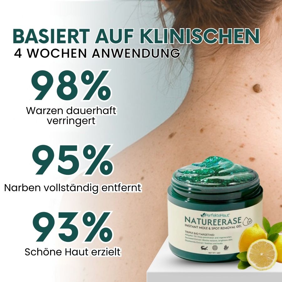 PerfekteHaut™ | Sofort-Gel zur Entfernung von Muttermalen & Flecken