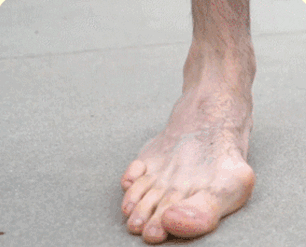 SchmerzFrei™ | Sofortige Linderung mit natürlicher Neuropathie-Creme in nur 7 Tagen!