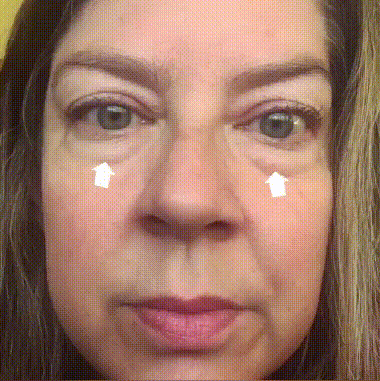 EyeFirm™ - Creme | Reduziert Schwellungen und Fältchen in 5 Minuten