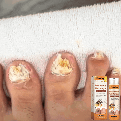 FungiKur™ Bienengift | Nagelpilz-Behandlungsspray