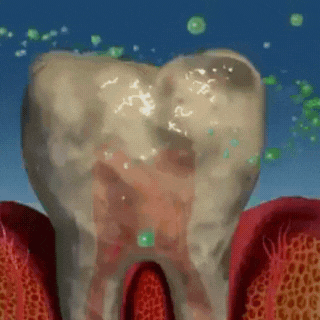 PureWhite™ | Zahnaufhellungs-Kit