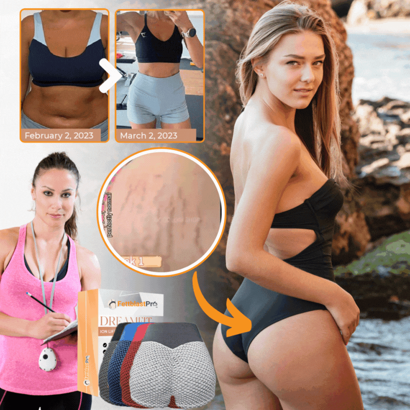 FettblastPro™ | Figurformende Shorts mit Lifting-Effekt