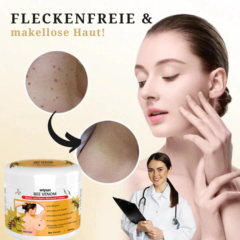 HautKlar™ | Beseitigen Sie lästige Hautwarzen in nur 1-3 Wochen!