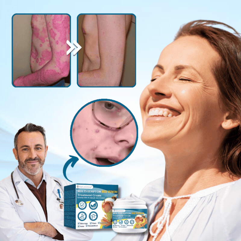 BeeLinderung™ |  Multi-Symptom-Bienengift-Behandlungscreme