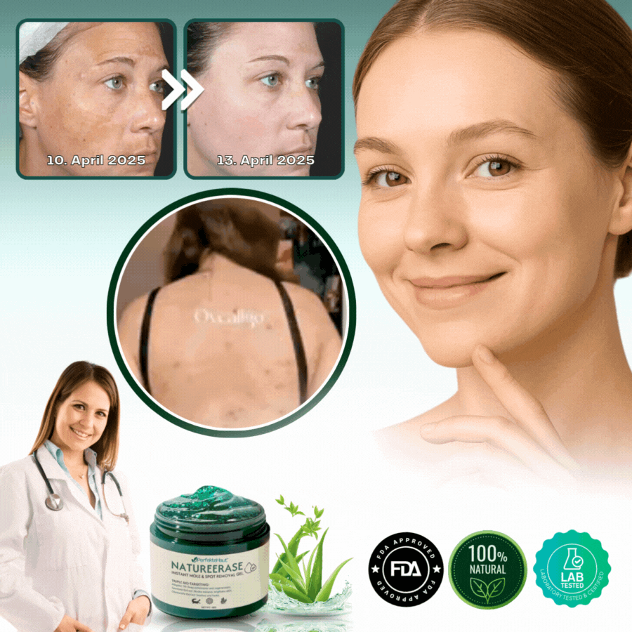 PerfekteHaut™ | Sofort-Gel zur Entfernung von Muttermalen & Flecken
