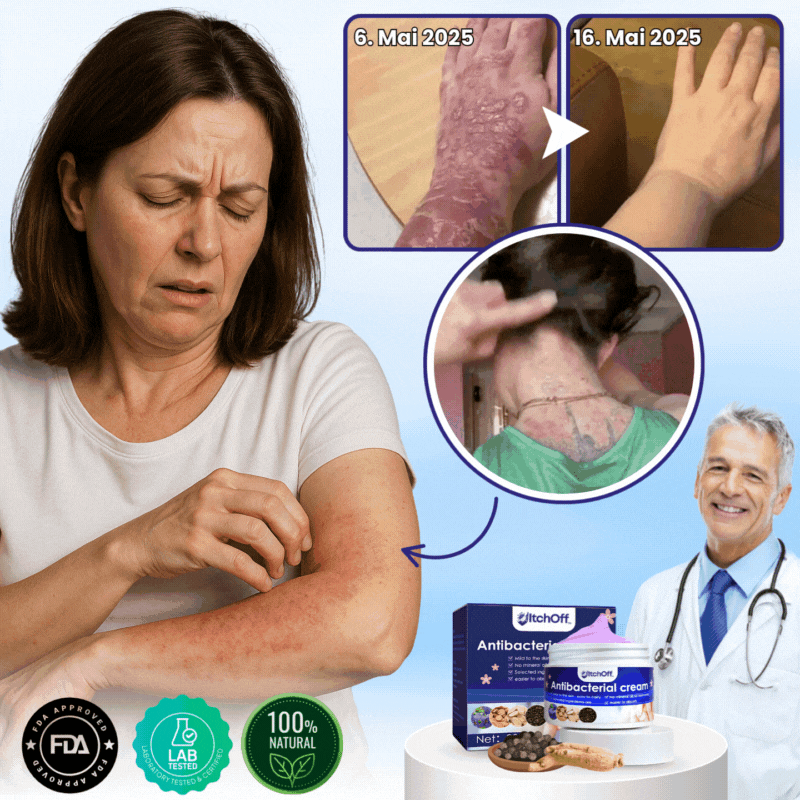 ItchOff™ | Antibakterielle Creme