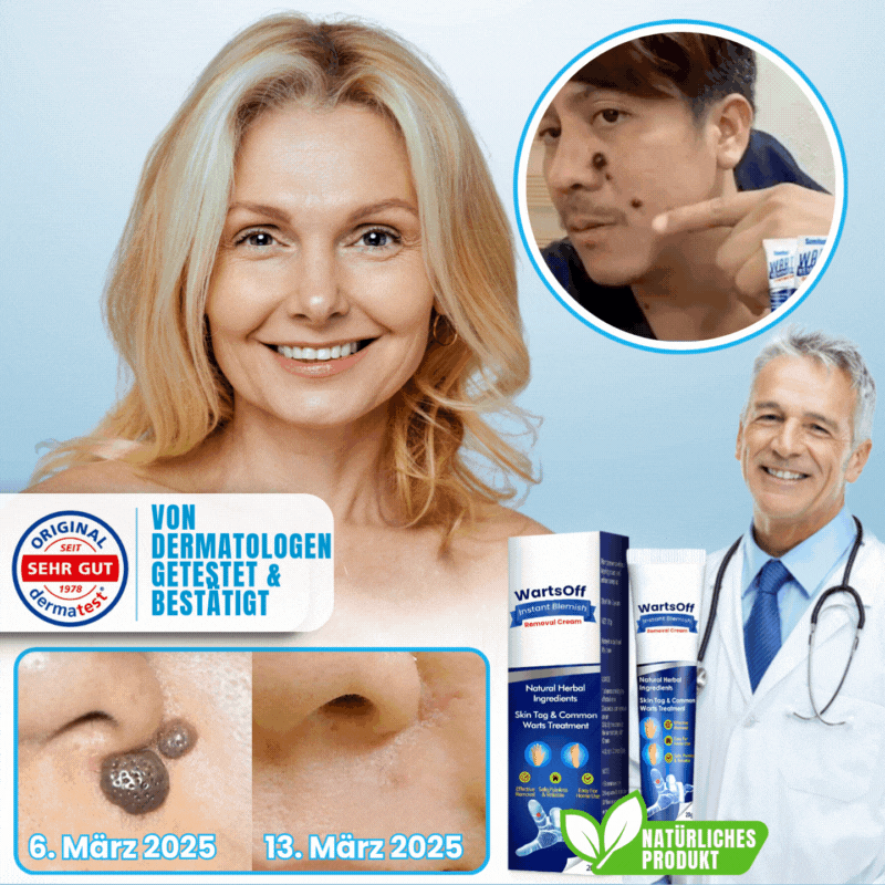 WartsOff™ | Entfernt Warzen sofort – schmerzlos