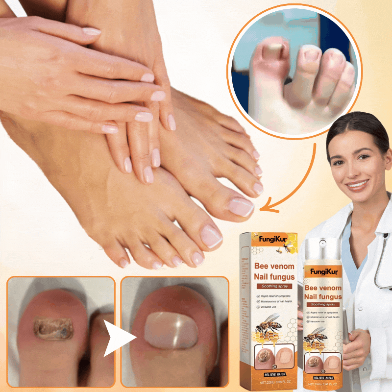 FungiKur™ Bienengift | Nagelpilz-Behandlungsspray