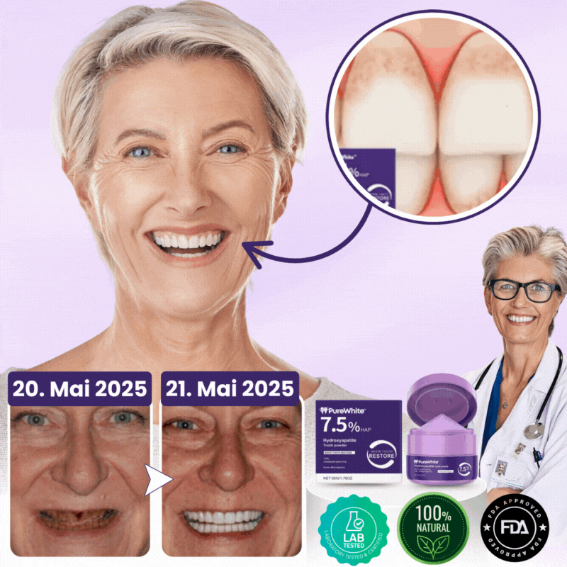 PureWhite™ | Zahnaufhellungs-Kit
