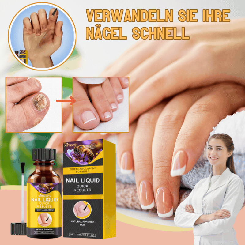 NagelPflege™ | Stellen Ihre hässlichen Nägel in nur 1 Woche wieder her!