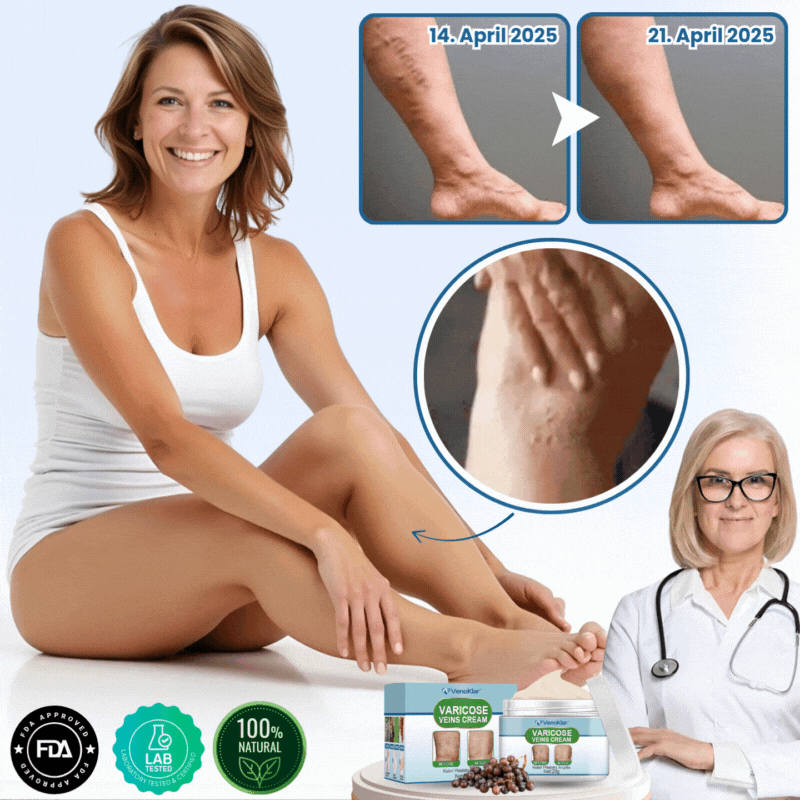 VenoKlar™ | Krampfadern- & Besenreiser-Creme