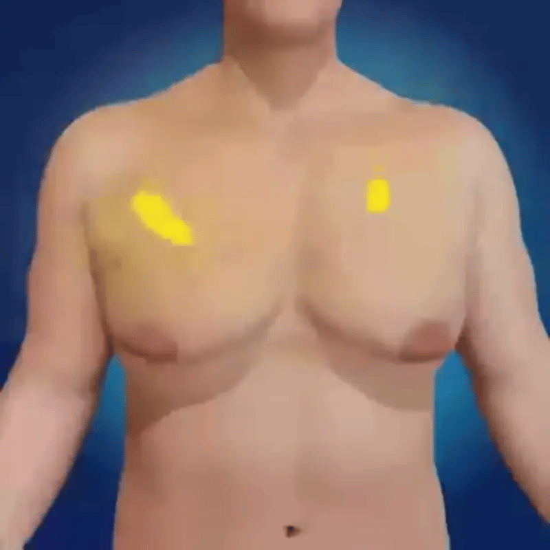 AlphaChest™ | Fettverbrennungsöl