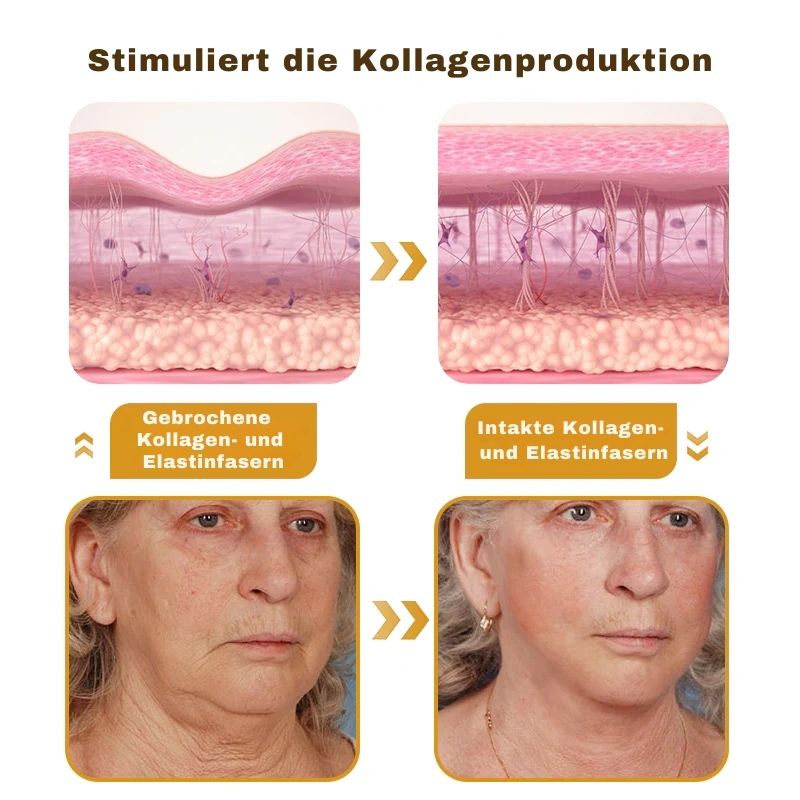 (🐼Produziert in Deutschland✅) 👩‍⚕️Elixier™ Botox Bienengift Faltenentfernungscreme - (LETZTER TAG 70% RABATT)