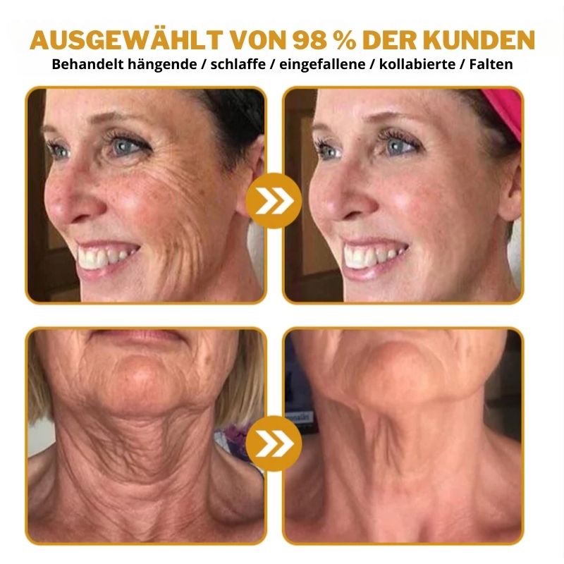 (🐼Produziert in Deutschland✅) 👩‍⚕️Elixier™ Botox Bienengift Faltenentfernungscreme - (LETZTER TAG 70% RABATT)