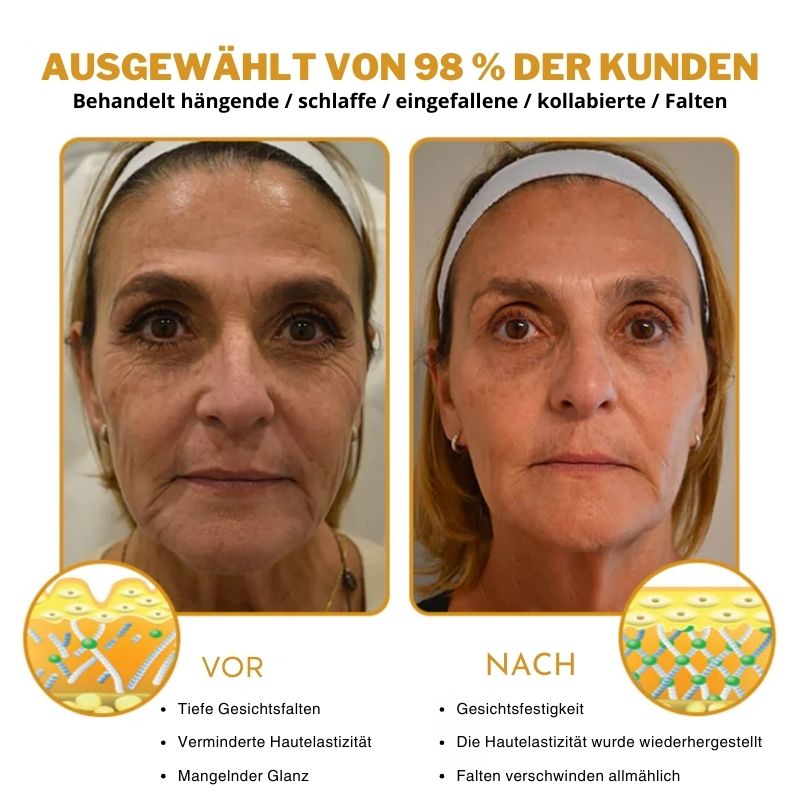 (🐼Produziert in Deutschland✅) 👩‍⚕️Elixier™ Botox Bienengift Faltenentfernungscreme - (LETZTER TAG 70% RABATT)