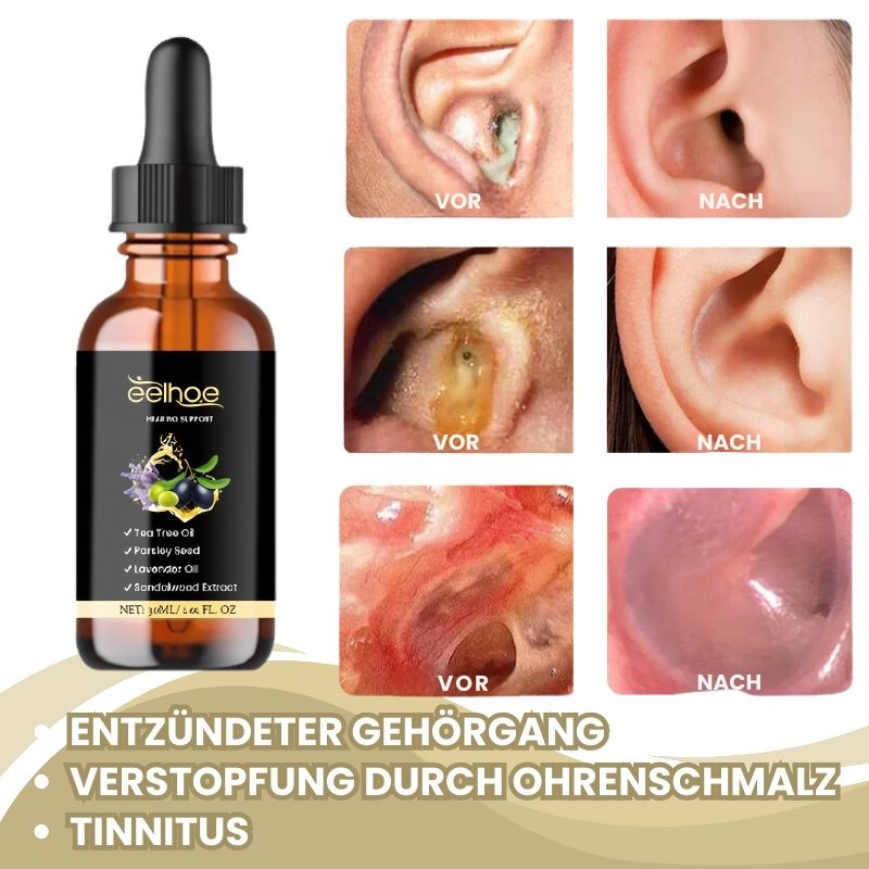EchoCalm® | Reduzieren Sie Tinnitus-Symptome um 99% in nur 7 Tagen