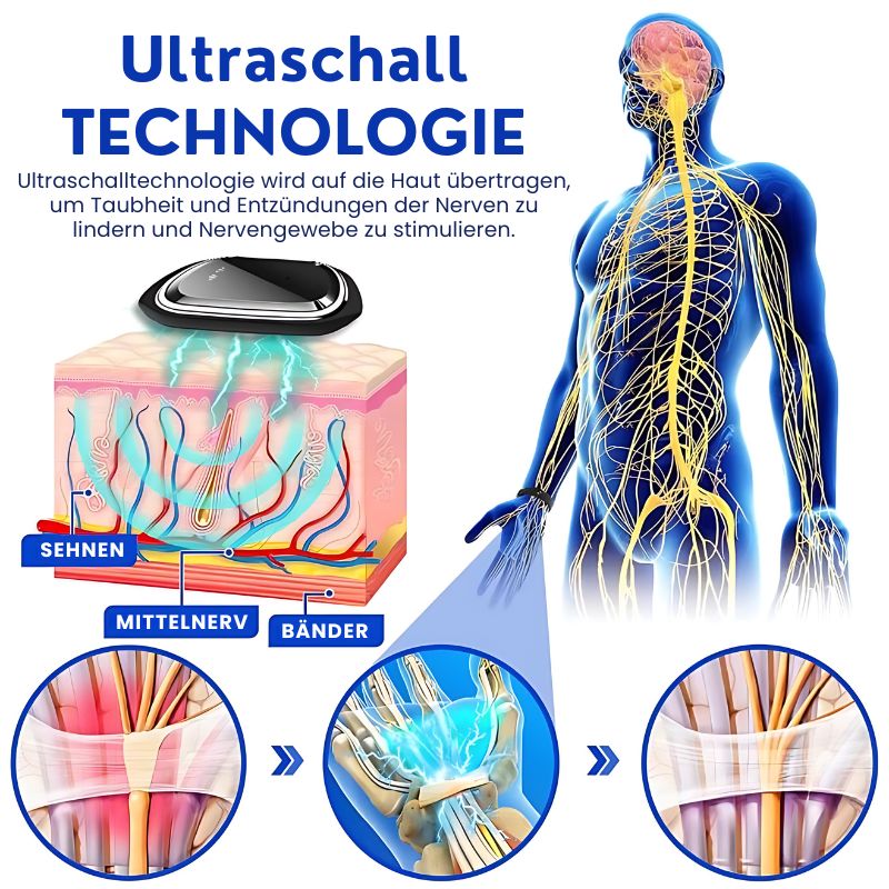 NumbLinderung™ | NumbSolved Ultraschallgerät