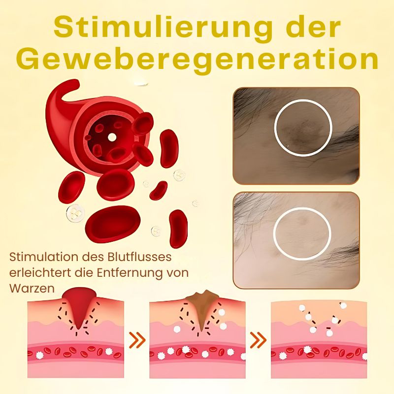 WarzenFix™ | Bienenstich-Reparatur- und Feuchtigkeitscreme