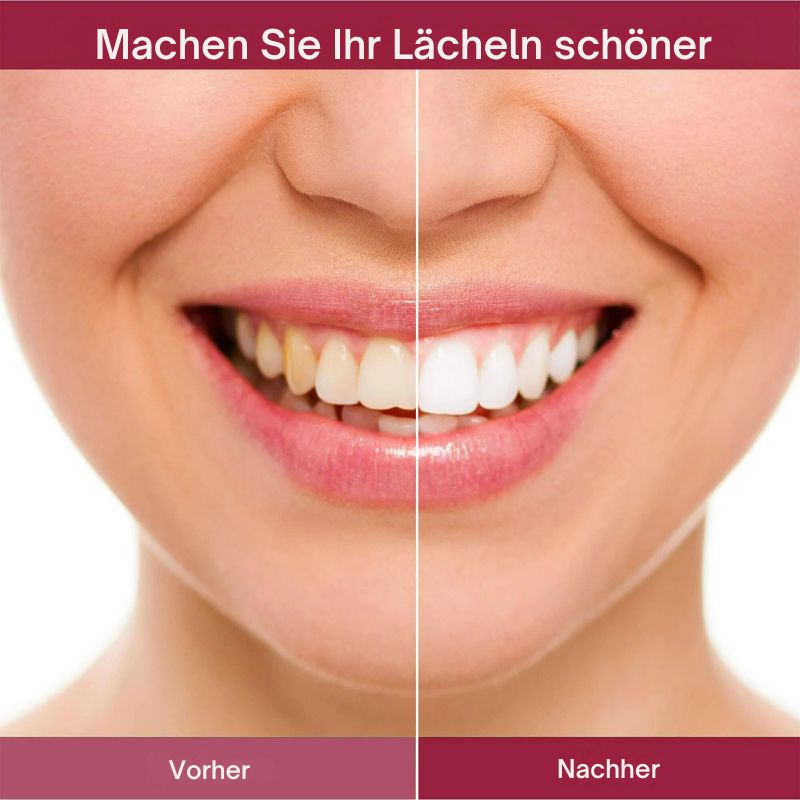 ReinWeiß™ | Probiotische Intensive Zahnaufhellungszahnpasta