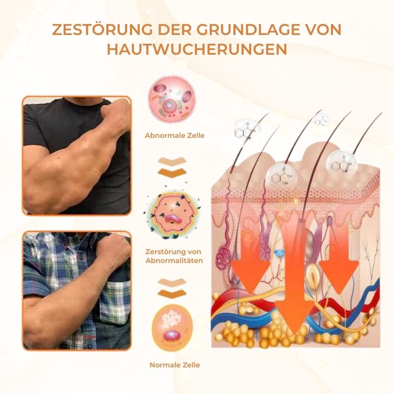 TagKlar™ |  Tags & Klumpen entfernen Gel