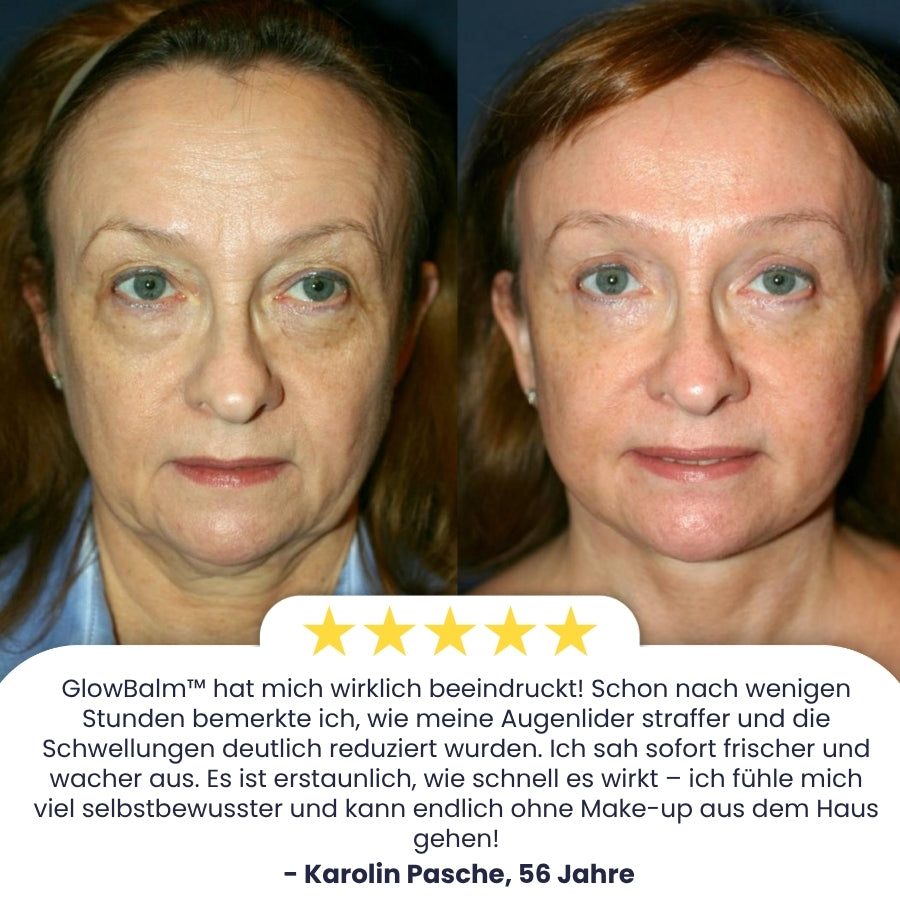 GlowBalm™ | Hagebutten Augenbalsam