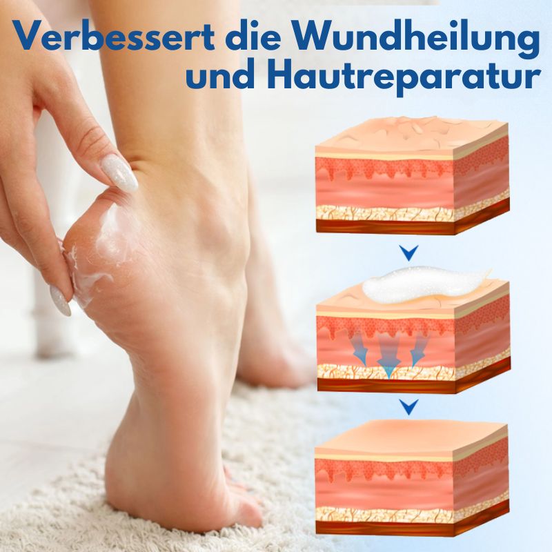 RisshautCreme™ | Creme zur Reparatur rissiger Haut