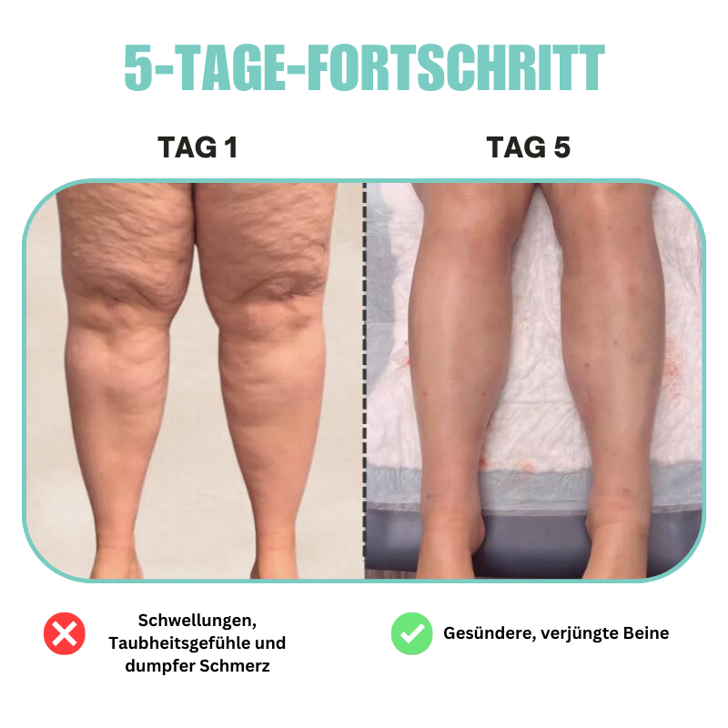 SootheBein™ | Therapeutische 3-in-1 Beinmassagegerät