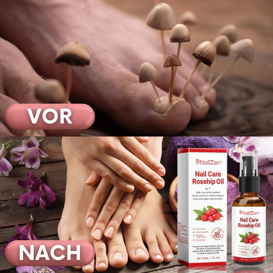 NailZen™ | Hagebuttenöl Nagelbehandlung