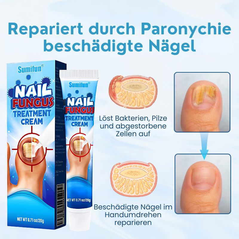 NagelHeil™ | Nagelpilz-Behandlungscreme